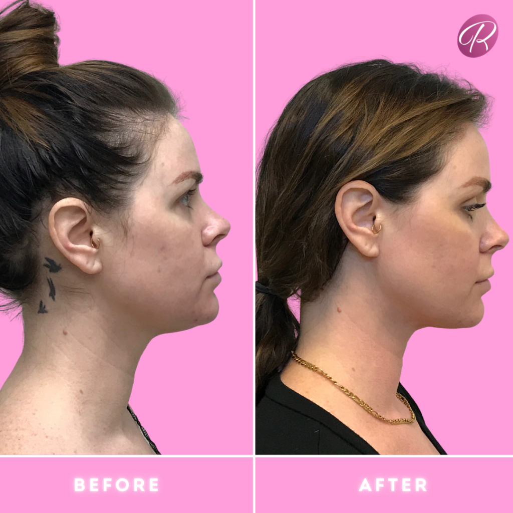 1672781261-588297a0-72fa-4465-be36-071e115470b0