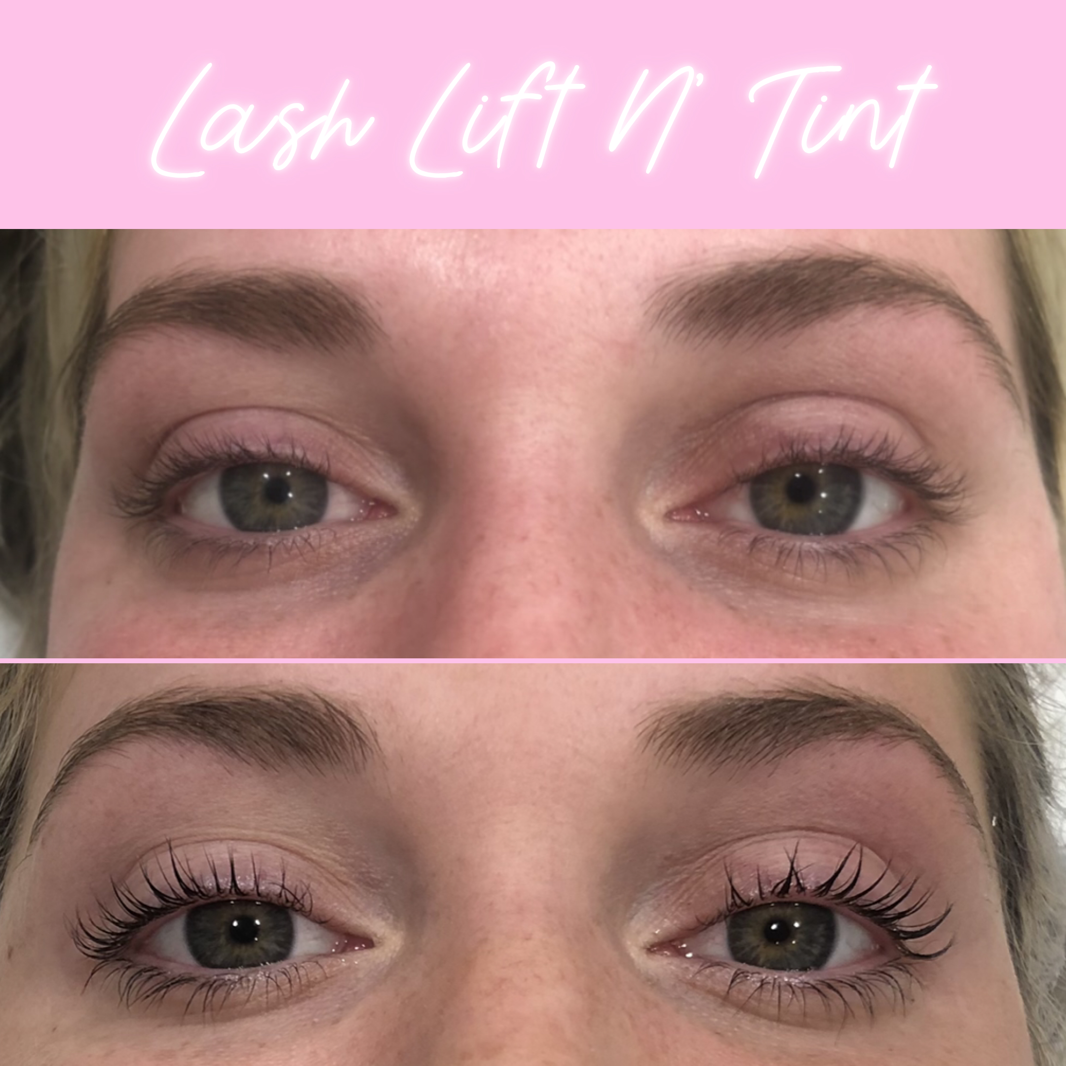 Lash Lift & Tint Before & After Gallery - Patient 13185 - Image 1